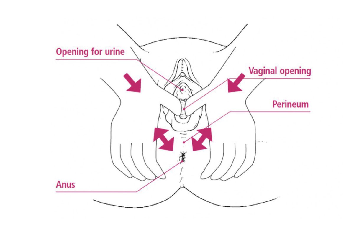 Ibu hamil yg nk bersalin tanpa koyak, once masuk 3rd trimester, dah boleh start buat perineal massage.

Bila selalu buat perineal massage ni, tissue dekat area situ akan jd more elastic.

So membantu utk bersalin tanpa koyak👍🏻