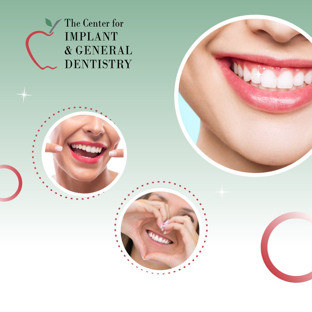 DentistsLindale's tweet photo. Illuminate your life with a radiant smile! 😁 At The Center for Implant &amp; General Dentistry, our top-notch teeth whitening services can make a world of difference. Schedule your appointment now!

#TeethWhitening #DentalHealth https://t.co/QDiu3w693N