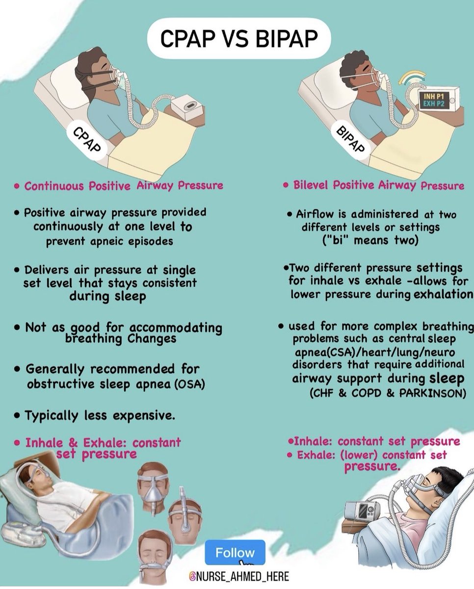 OGdukeneurosurg's tweet photo. What are differences of CPAP and BIPAP ? https://t.co/CsX6GOaY0c