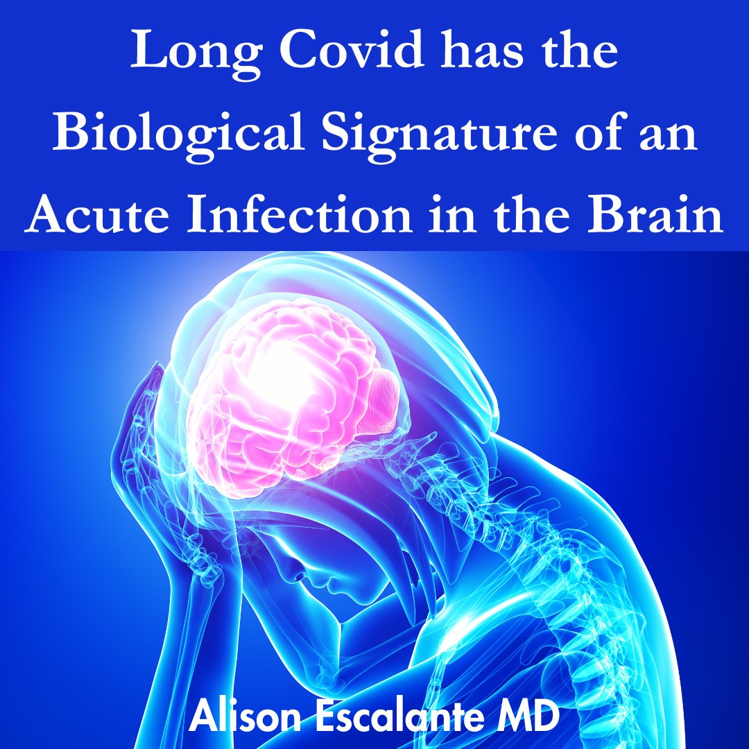 AEscalanteMD's tweet image. According to a new study, Long Covid looks like an acute covid infection in the brain. The biological signature was distinct and showed that Long Covid is real and not all in patient&apos;s heads. 
#longcovid #researcharticles