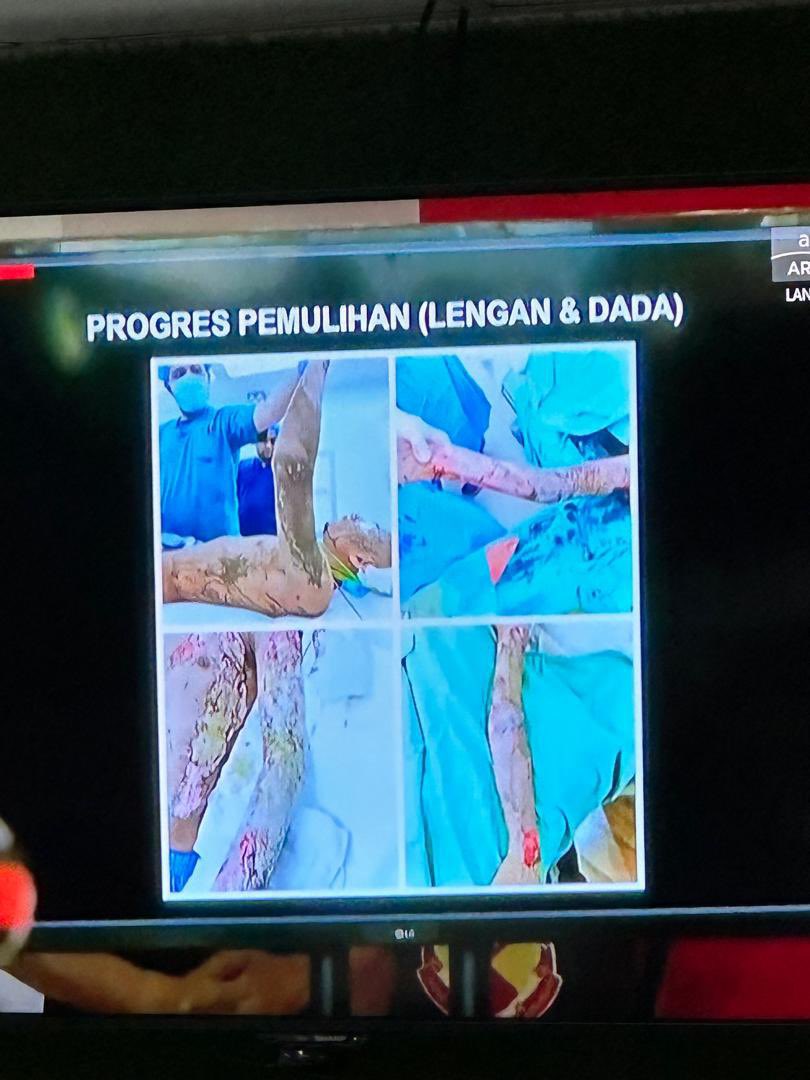 Ni untuk lengan dan dada. Memang pukimak yang mastermind ni