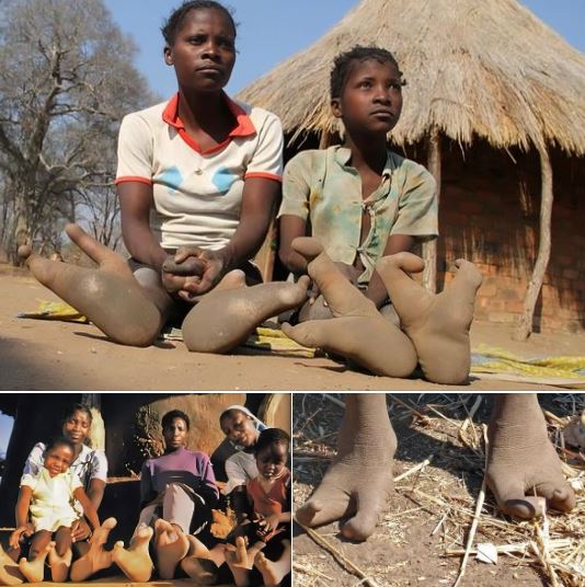 The Doma tribe of Zimbabwe have two toes. They are also called the ostrich people for that reason.

Every time I learn something new, I also learn humility because then I realise there's so much of this world that I don't know yet and will never know even in a thousand years!