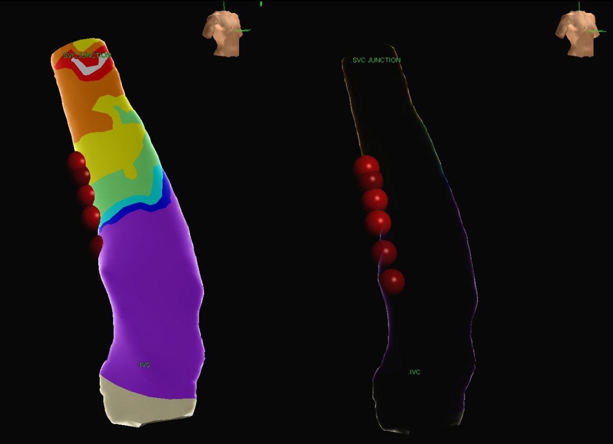 Zain Khalpey, MD, PhD, FACS tweet media