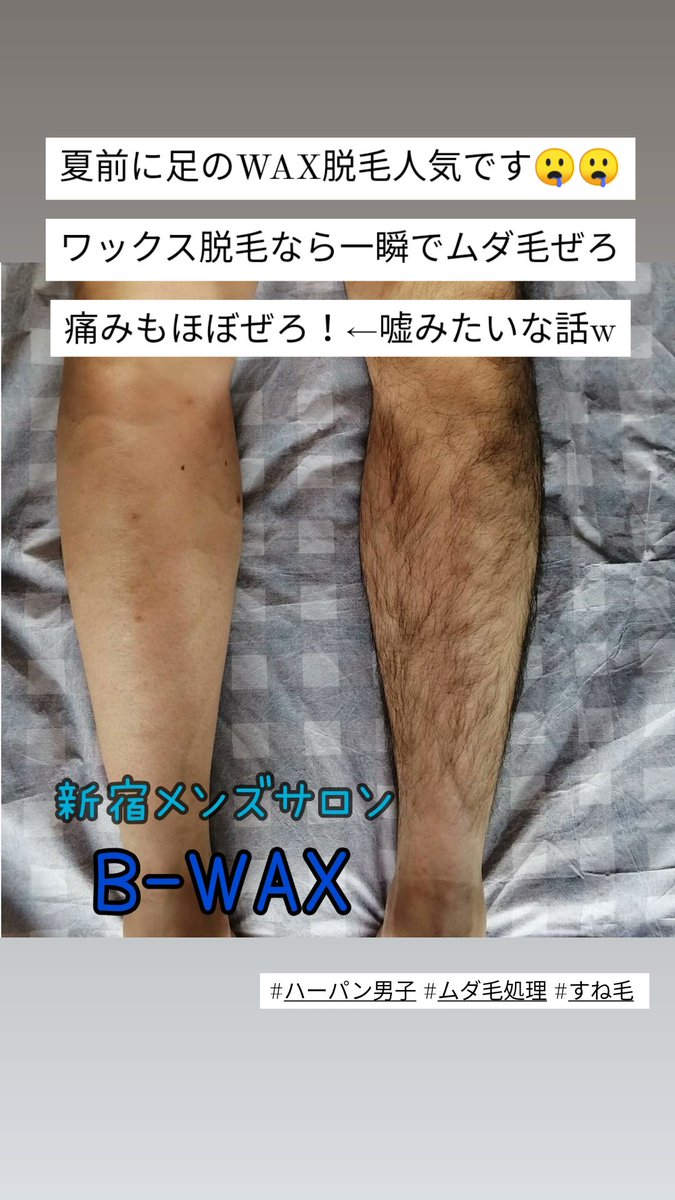 BWAX16's tweet photo. 夏前🌊🌺

間もなく夏が始まります😊

ワックス脱毛なら一瞬でムダ毛ぜろ🌞
あのＴ字で処理したあとのジョリジョリ🤒

肌荒れぜろ🙅🙅🙅

すべっすべのお肌が痛み０で手に入ります🌻

#ワックス脱毛 #スネ毛 #新宿ワックス脱毛 https://t.co/lxn3HlKrX9