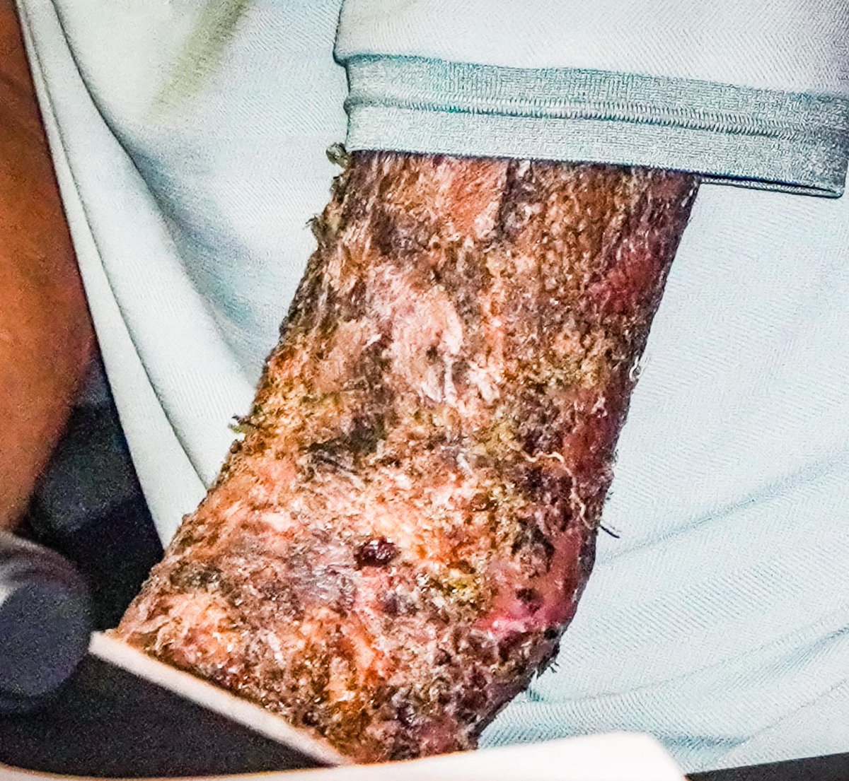 Apalah dosa budak Miki ni sampai ada yang sanggup naya dia sampai teruk gini? 

Kepada si pelaku, ke neraka je lah kau.