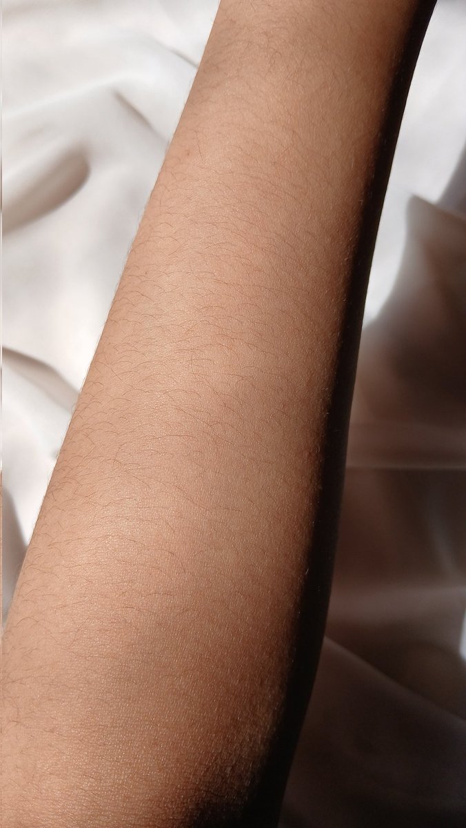 s0ftgurll's tweet photo. Emang boleh punya tangan se-mulus ini ? 😆

      Before                           After https://t.co/XVoMOhqZco