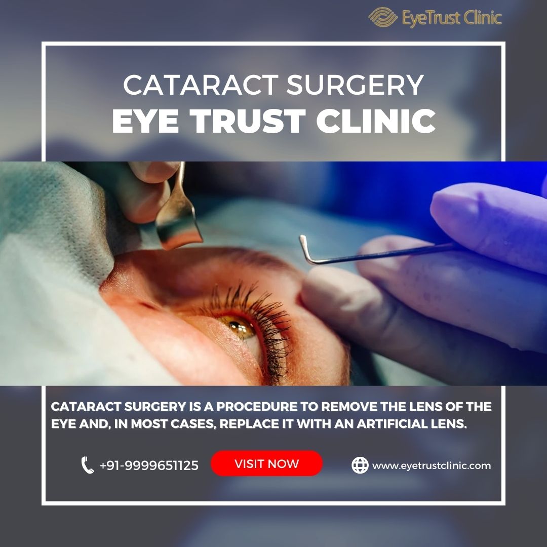 Eyetrustclinic's tweet photo. Cataract Surgery " Eye Trust Clinic" - Book Your Appointment Now !!
Contact: (+91)-9999651125, (+91)-8377096565
Visit:https://t.co/HwQpSXqThx
#CataractTreatment #EyeTrustClinic #VisionCare #CataractSurgery https://t.co/yRzy7DfHSl