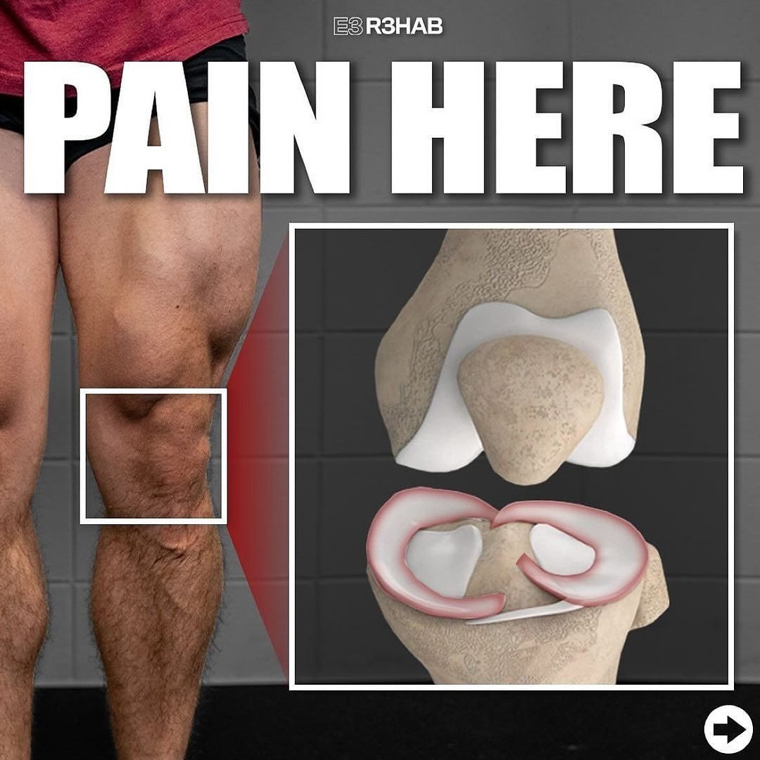 Knee Pain?

Do this 👇👇👇