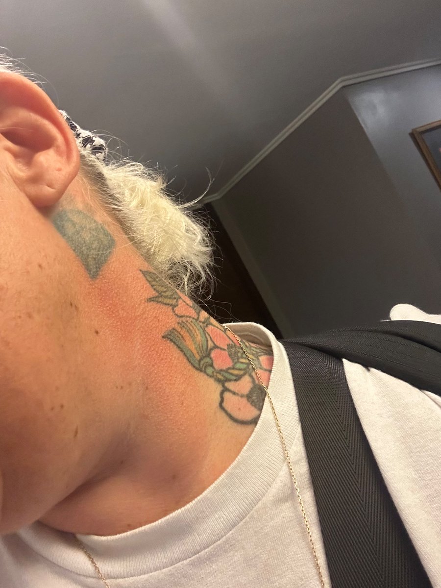 krystalclair's tweet photo. @hotelscomhelp did I mention having to use my inhalers multiple times when in the room for just a few minutes? Oh! And a lovely rash appeared! https://t.co/wz014CcNDG