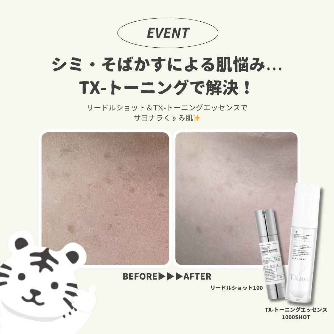 🩶EVENT🩶 シミ・そばかすにお悩みの方注目！ #リードルショット & #TX