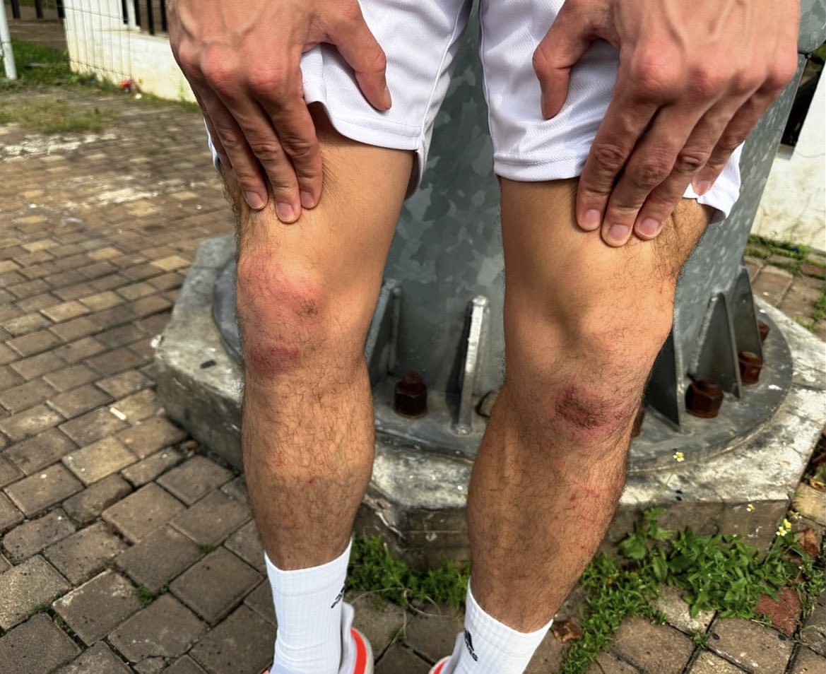 avoirbaeami's tweet photo. Dengkul thom haye gara2 selebrasi 😭
Tapi dia masih bisa lari yaa, gue sih udh nangis 😭 https://t.co/Ze46CcVM02