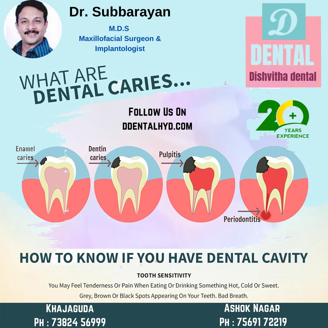 DDishvitha's tweet photo. Best Dental Hospital In Ashoknagar - Hyderabad. #ashoknagar #hyderabad #narayanguda #himyathnagar #chikkadpally #rtcxroads #hyderabaddentist #dentalhyderabad #hyderabaddentalclinics #dentalclinicsofhyderabad #domalguda #secunderabad #indirapark_hyd #IndiraPark #khajaguda https://t.co/UXTNxxjP9m