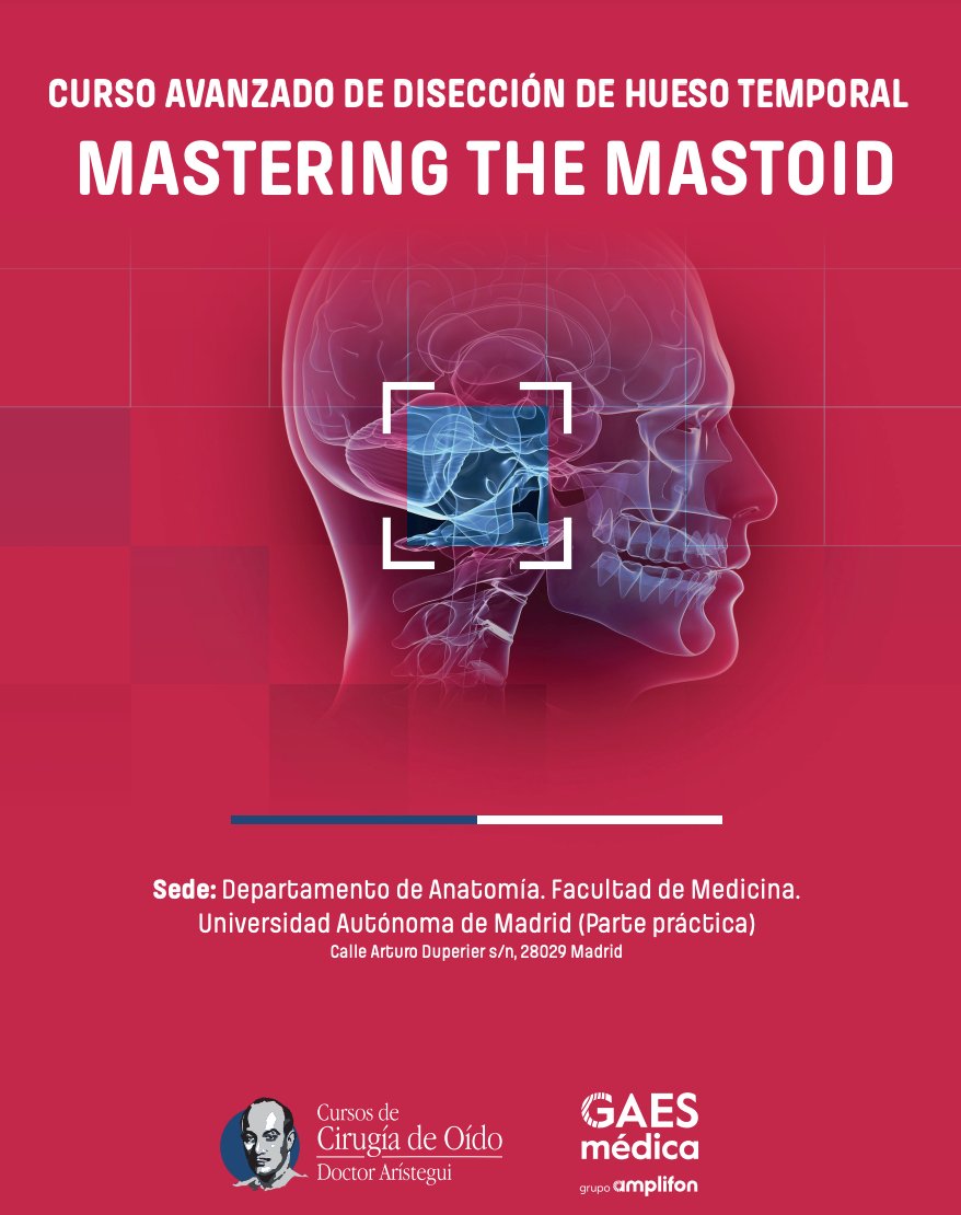 IFMEC (@cursosifmec) on Twitter photo ¡Eleva tu carrera en Otología! Únete al "Curso Avanzado de Disección de Hueso Temporal Mastering the Mastoid" dirigido por el Dr. <a href="/MiguelAristegui/">Miguel Arístegui</a> y patrocinado por GAES-Amplifon. Aprende de expertos líderes en el campo del 18 al 20 de septiembre de 2024.
ifmec.com/es/producto/cu… ¡Eleva tu carrera en Otología! Únete al "Curso Avanzado de Disección de Hueso Temporal Mastering the Mastoid" dirigido por el Dr. <a href="/MiguelAristegui/">Miguel Arístegui</a> y patrocinado por GAES-Amplifon. Aprende de expertos líderes en el campo del 18 al 20 de septiembre de 2024.
ifmec.com/es/producto/cu…