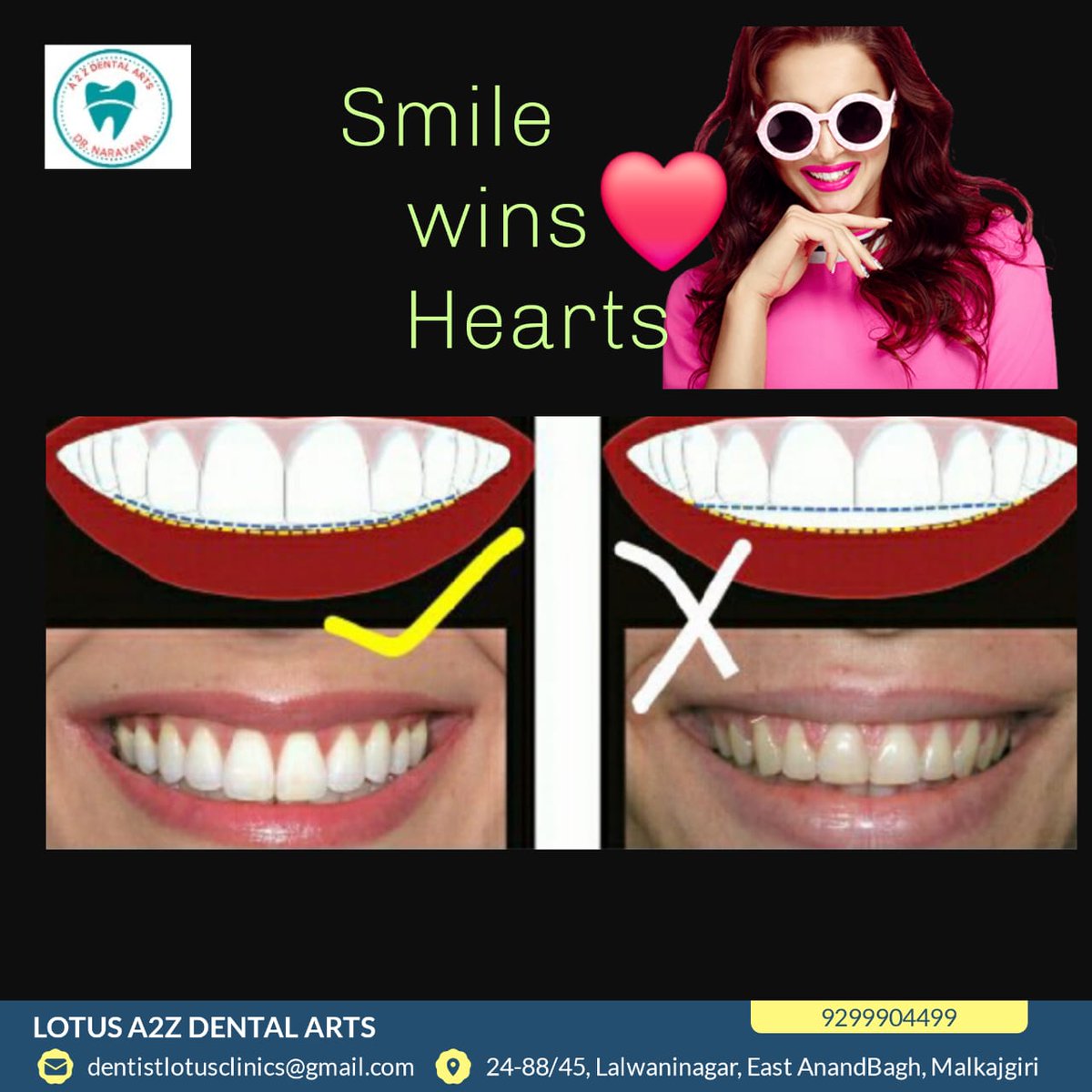 Drnarayandental's tweet photo. Best dental hospital #Anandbagh #Malkajgiri #secunderabad #Secunderabadmetro #Hyderabad #Tarnaka #malkajgirimla #MALKAJGIRIMP #dentalimplants #dentalclinic #wisdomteeth #wisdomteethremoval #snoring #dental #dentist #trending #rct #rootcanalretreatment #rootcanals #sportsguard https://t.co/SU9R4NWoF1