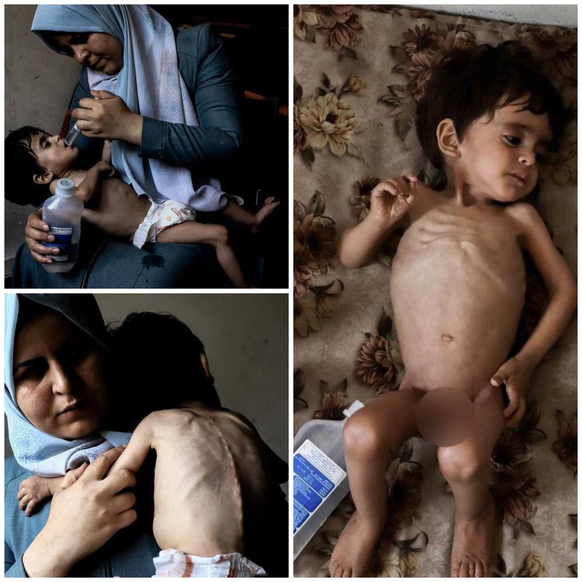 tamerqdh's tweet image. جوع قاهر ، في قطاع غزة ، ولا احد يتحدث !!  ..