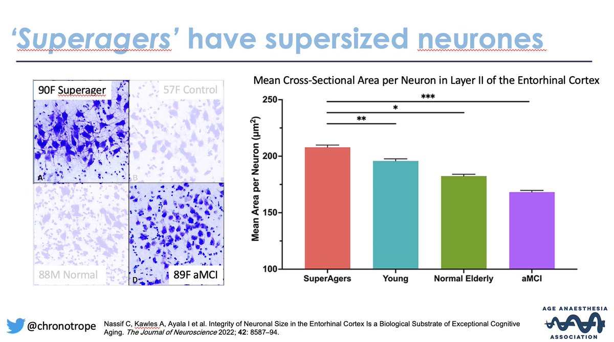 Looking forward to talking about aging brains, pEEG and one of my favourite topics - SUPERAGERS!

#AAACONF Age Anaesthesia <a href="/Medtronic/">Medtronic</a> <a href="/Narcotrend/">Narcotrend</a> <a href="/MediplusTIVA/">Mediplus Anaesthesia</a> @BBraunUK