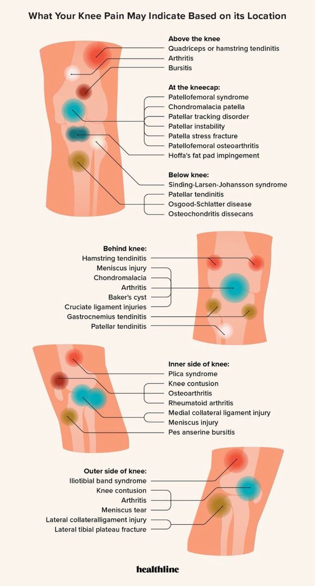 Knee pain by location