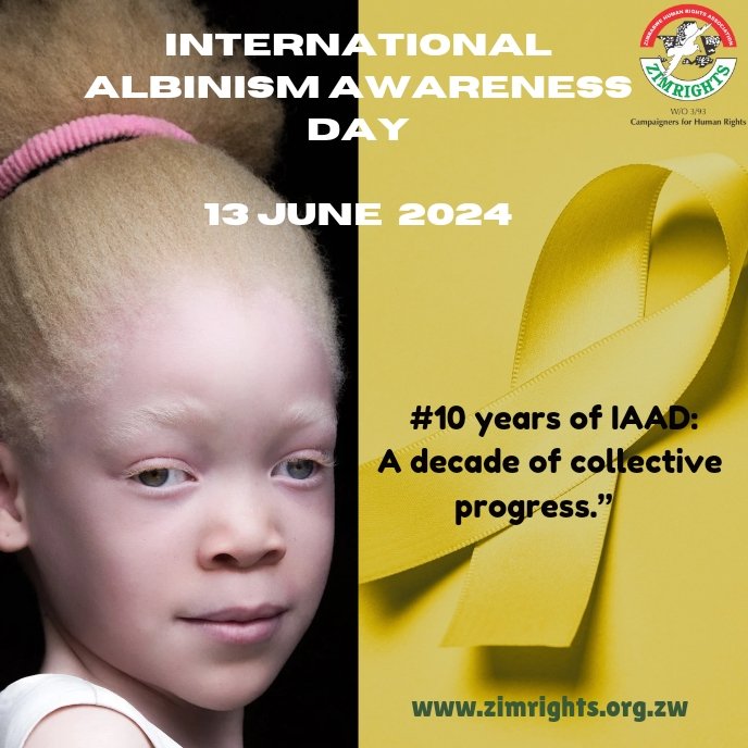 June 13, 2024

Zimbabwe Human Rights Association (ZimRights) Press Statement on International Albinism Awareness Day

Today, as we observe International Albinism Awareness Day under the theme “10 years of IAAD: A decade of collective progress,” ZimRights, stands in solidarity