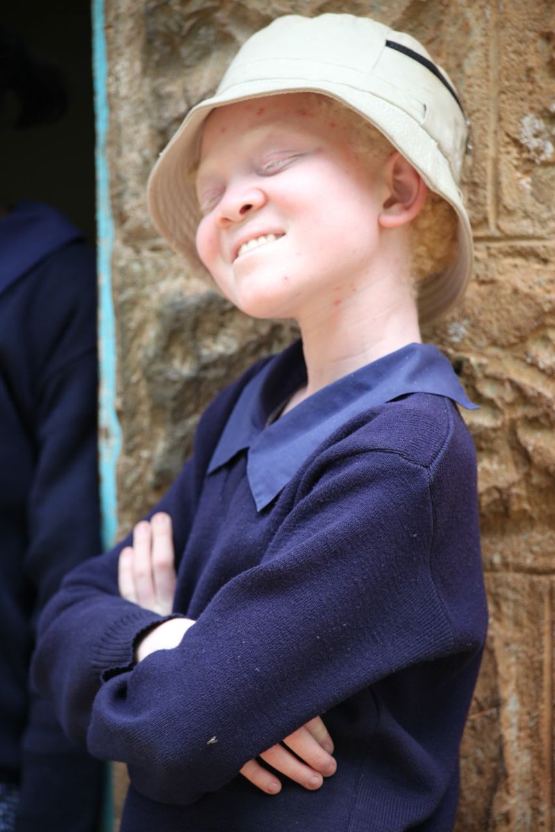 Happy #InternationalAlbinismAwarenessDay. This year's theme is "A decade of collective progress," to celebrate all the strides made within the movement and promote inclusivity and full and equal rights for persons with albinism. 🙂 #AlbinismDay #10IAAD #IAAD2024 <a href="/IreneKirika2/">Irene Kirika, O.G.W</a>
