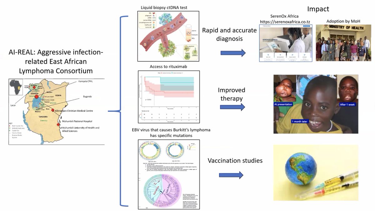 Graham Collins (@graham74gc) on Twitter photo Incredible work from <a href="/AnnaSchuh3/">Anna Schuh</a> and colleagues focusing on a hugely underserved group - children with Burkitt lymphoma in Africa. Using liquid biopsy to speed diagnostics and rituximab to improve outcomes. From the AI-REAL consortium. Presented at Burkitt consortium #EHA24 Incredible work from <a href="/AnnaSchuh3/">Anna Schuh</a> and colleagues focusing on a hugely underserved group - children with Burkitt lymphoma in Africa. Using liquid biopsy to speed diagnostics and rituximab to improve outcomes. From the AI-REAL consortium. Presented at Burkitt consortium #EHA24