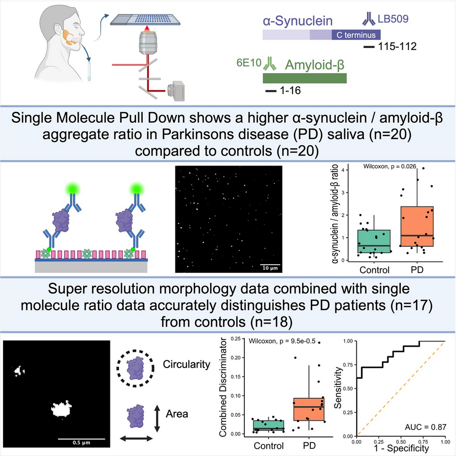 The Science of Parkinson's (@scienceofpd) on Twitter photo A new pilot study from <a href="/KlenermanLab/">KlenermanLab</a> et al tested an antibody-based single-molecule pulldown assay to quantify salivary α-synuclein & amyloid-β peptide aggregate numbers (#Parkinsons & #Alzhiemers); Saliva aggregates retain relevant structural information
academic.oup.com/braincomms/art⦠A new pilot study from <a href="/KlenermanLab/">KlenermanLab</a> et al tested an antibody-based single-molecule pulldown assay to quantify salivary α-synuclein & amyloid-β peptide aggregate numbers (#Parkinsons & #Alzhiemers); Saliva aggregates retain relevant structural information
academic.oup.com/braincomms/artā¦