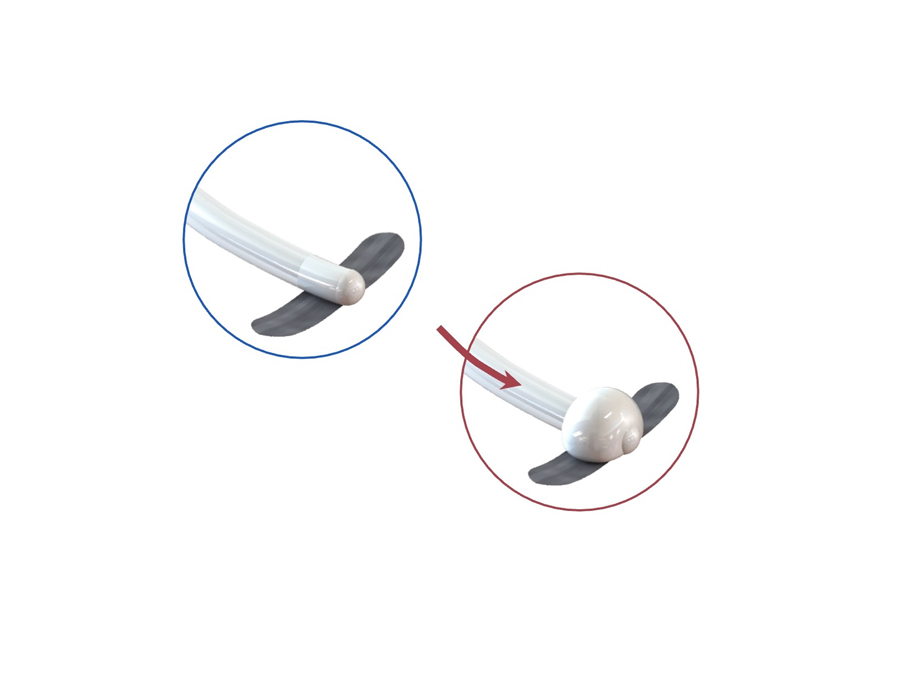 Science Robotics (@scirobotics) on Twitter photo New in Science #Robotics: Soft #robotic actuators implanted in rats offer a new reversible way to model aortic banding. <a href="/ellentroche/">Ellen Roche MIT</a>
📄: scim.ag/7jD New in Science #Robotics: Soft #robotic actuators implanted in rats offer a new reversible way to model aortic banding. <a href="/ellentroche/">Ellen Roche MIT</a>
📄: scim.ag/7jD