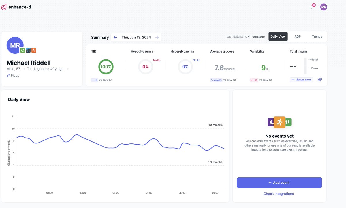 Michael Riddell, PhD (@mcriddell1) on Twitter photo I #love the new dashboard look of my #glucose on <a href="/enhance_d/">Enhance-d</a>. Now I will go for a #run and ruin my perfect #T1D #glucose ….Then I will eat too many #Carbs.. and ruin it some more...Check it out my friends! <a href="/5Dess/">Dessi Zaharieva</a> <a href="/AKoutnik/">Andrew Koutnik, Ph.D.</a> @SheriColberg <a href="/aaronjkowalski/">Aaron Kowalski</a> I #love the new dashboard look of my #glucose on <a href="/enhance_d/">Enhance-d</a>. Now I will go for a #run and ruin my perfect #T1D #glucose ….Then I will eat too many #Carbs.. and ruin it some more...Check it out my friends! <a href="/5Dess/">Dessi Zaharieva</a> <a href="/AKoutnik/">Andrew Koutnik, Ph.D.</a> @SheriColberg <a href="/aaronjkowalski/">Aaron Kowalski</a>