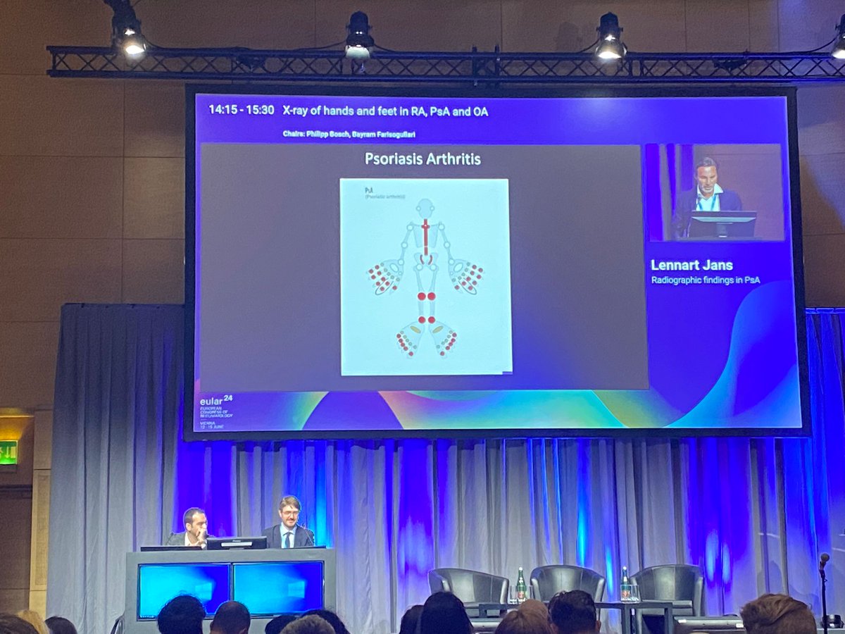 It was a great honor to co-chair our "X-rays of hands and feet" session with <a href="/BFarisogullari/">Bayram Farisogullari</a>, Lennart Jans, Margreet Kloppenburg and Iris Eshed! 😃 What practical radiological session would you like to see at #EULAR25?
#EULAR24 <a href="/EMEUNET/">EMEUNET</a>