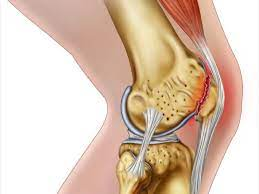 7 أطعمة تزيد من #غضاريف العظام وتجددها:

يعمل الغضروف مثل الوسادة ، حيث يحمي عظامك عند المفاصل أثناء الحركة. الغضروف هو نوع من النسيج الضام الذي يعمل كوسيط تواصل بين العناصر العضلية الهيكلية مثل العظام والأربطة والعضلات. يتم تجديد الغضروف وفقًا للطعام الذي تتناوله. أظهرت بعض