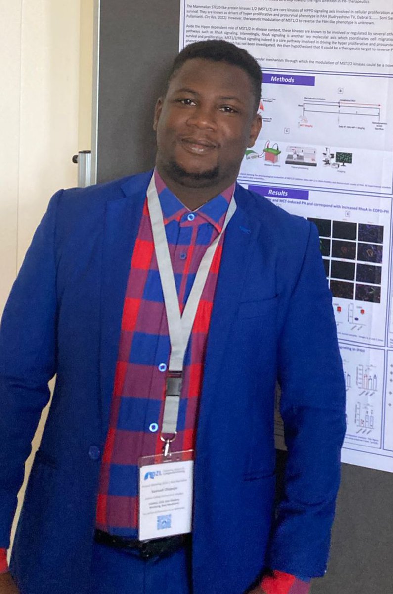 Samuel Olapoju (@olapoju_samuel) on Twitter photo Last week, it was a great pleasure to have presented my research inform of poster presentation at the just concluded German Centre for Lung Research 2024 congress. Thanks to my amazing supervisor <a href="/pullamsetti/">soni pullamsetti</a> and all members of <a href="/PullamsettiL/">Pullamsetti Lab</a> Last week, it was a great pleasure to have presented my research inform of poster presentation at the just concluded German Centre for Lung Research 2024 congress. Thanks to my amazing supervisor <a href="/pullamsetti/">soni pullamsetti</a> and all members of <a href="/PullamsettiL/">Pullamsetti Lab</a>