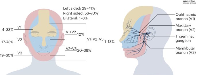 DiseasePrimers's tweet image. This figure shows the anatomical localization of pain in #trigeminal #neuralgia go.nature.com/4aEbVe9
