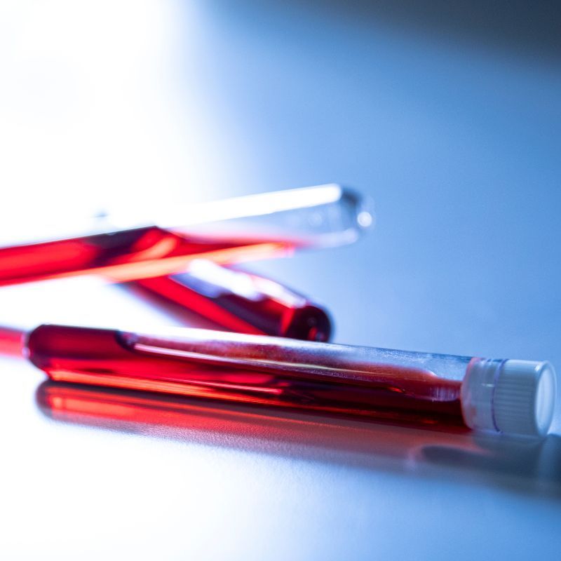 Phlebotomy_U's tweet photo. Donating blood is a noble act that can save lives. Many people are familiar with the process of donating a pint of blood, fewer may know how this translates to the smaller, more manageable vials often used in medical tests and research. Learn more here: https://t.co/tBHsq3uRXV https://t.co/MLwZD5SCiA