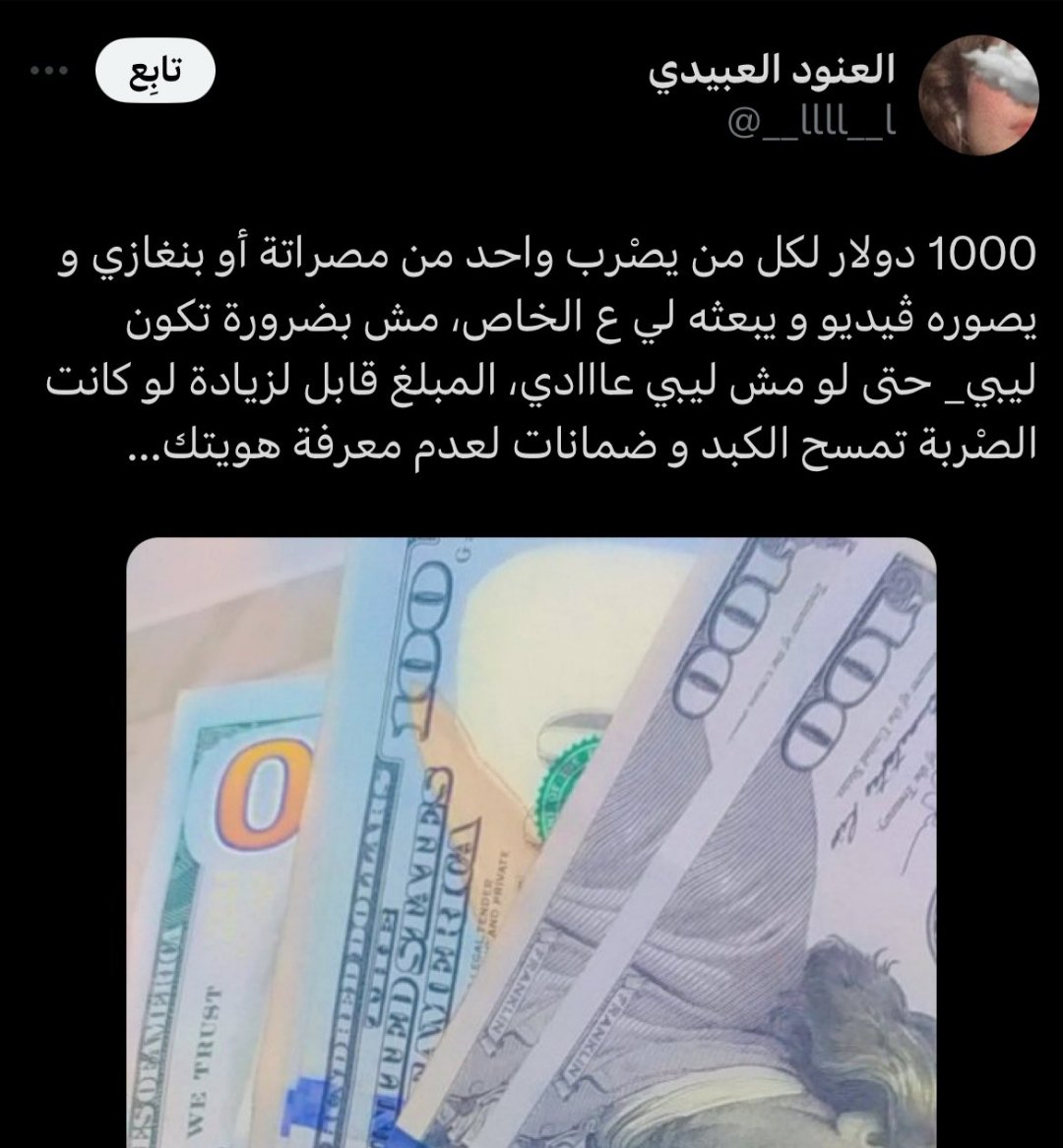 AlbyAlrby79504's tweet image. ،،،، 
قفل #النت في #ليبيا واجب #وطني 
العاهات تنتشر بشكل رهيب 🤚

#𝑅𝑈𝐵𝐴🍄