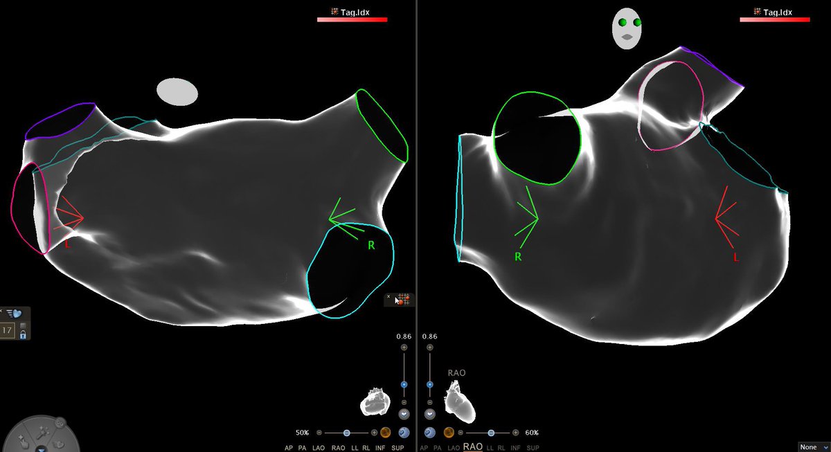 Roy Chung tweet media