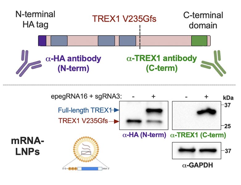 Miner Lab (@miner_lab) on Twitter photo And now—with the help of amazing collaborators <a href="/PennMedicine/">Penn Medicine</a> —we can convert the toxic TREX1 protein (dominant, truncated TREX1 mutant) into the full-length TREX1 using a modified CRISPR approach. The next challenge is optimizing delivery to the blood vessel wall, but we believe And now—with the help of amazing collaborators <a href="/PennMedicine/">Penn Medicine</a> —we can convert the toxic TREX1 protein (dominant, truncated TREX1 mutant) into the full-length TREX1 using a modified CRISPR approach. The next challenge is optimizing delivery to the blood vessel wall, but we believe