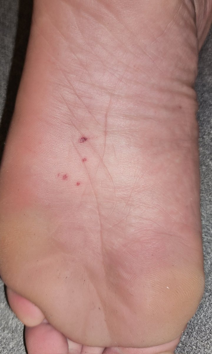 Aftermath of fiber cane Falaka today. Who would like to see the video?