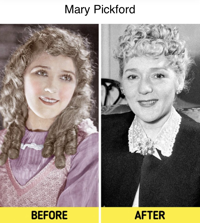 To look young and fresh played a cruel joke on silent film legend Mary Pickford. She was worried about aging and did a facelift too early. It wasn’t successful — she couldn’t smile or express her emotions fully, which was important in the silent film world.