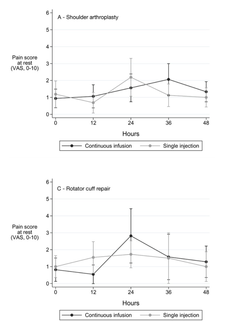 A continuous infusion for an interscalene plexus block does not provide superior analgesia after major shoulder surgery when compared with a single injection with multimodal analgesia. Check out our last article (open access: shorturl.at/gZ5ws) ! Congrats on the team!