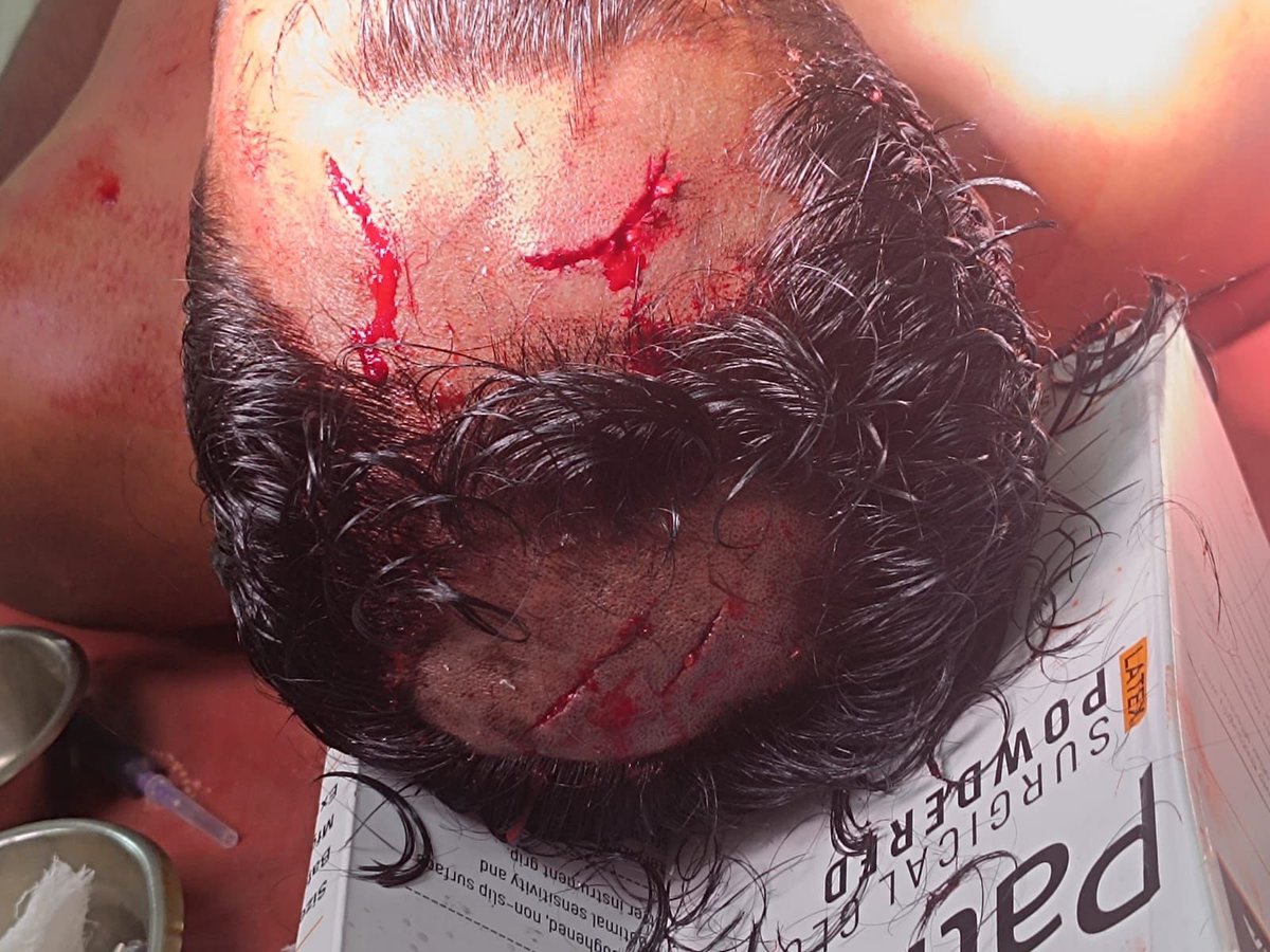 FordaIndia's tweet photo. ‼️Doctors are under SEIGE! 

Two Horrible incidents from #Eastern states of #india ! 

• Dr. Amlan Kumar Bhoi allegedly kidnapped in #Odisha by Maoists over a Post mortem feud. 

•Dr. Nikhil H savagely assaulted in #Tripura with sharp weapons. 

New Govt on 4th June should prioritise our long term demand of #CentralHealthCareProtection Act otherwise the next 5 years will witness the downfall of medical education sector in India. 

@PMOIndia @AmitShah @CMO_Odisha @DrManikSaha2 @MoHFW_INDIA @mansukhmandviya @OfficeOf_MM