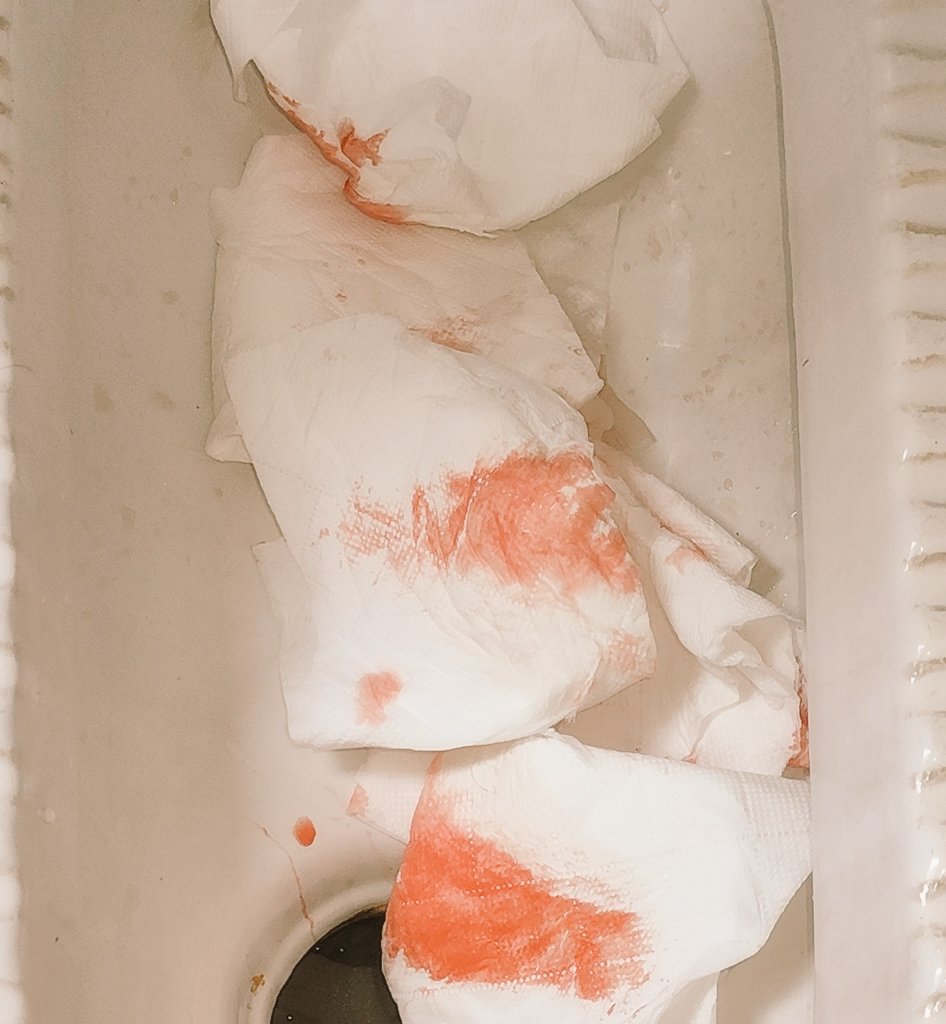 福利姬压死个梨吖分享的黄推图片3 - 网红私拍内容