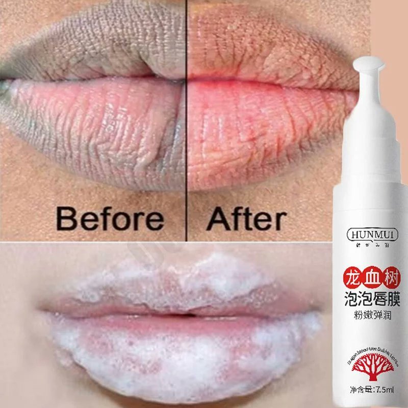 spillOOTDElStr's tweet photo. Haii sobat shopee
Ada yang masih merasa bibir nya gelap dan kering?
Lip Care Treatment Pencerah Bibir Perawatan Untuk Bibir Gelap. kosmetik bibir  serum bibir untuk bibir hitam
 Dapatkan sekarang juga disiniii yaaaa 👇👇👇👇
🔗 https://t.co/89OeFf8N3v
🔗 https://t.co/89OeFf8N3v https://t.co/MDaCwPQ7iH