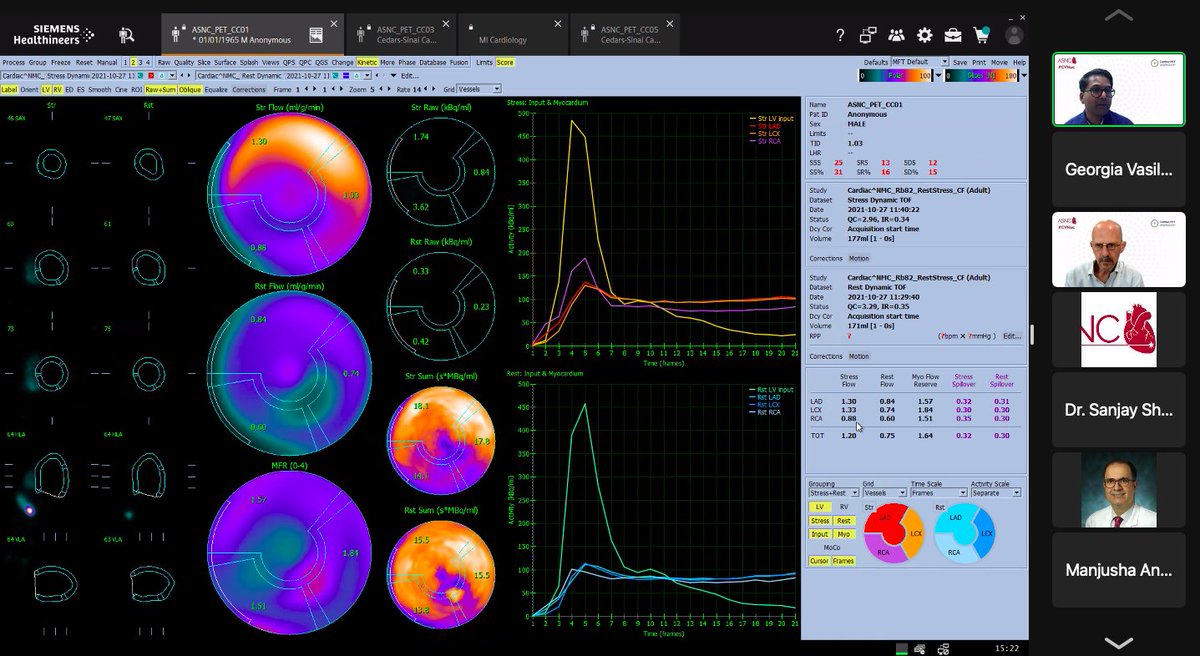gmvasilakis's tweet image. Continuing with our #MPI case highlights - Dr. Arumugam shares a great case where it is important to examine the flow data by the vascular territory AND the segmental flows. 

Segmental flows ➡️➡️ Patterns of abnormality  

#CVNuc @MyASNC @ParthibanArum18