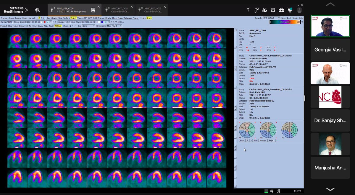 gmvasilakis's tweet image. 💥🚀QUIZ TIME at our #MPI session - What is the diagnosis?
Share your thoughts in the comments!💬#CVNuc @MyASNC