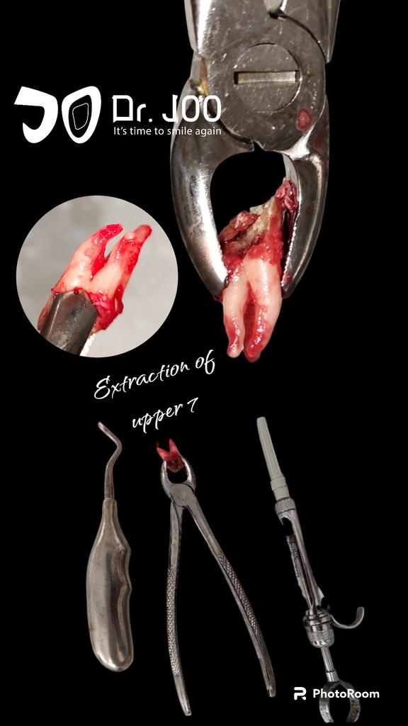 J0oooooo0's tweet photo. Extraction case 🌋 https://t.co/WUhrewVWOJ