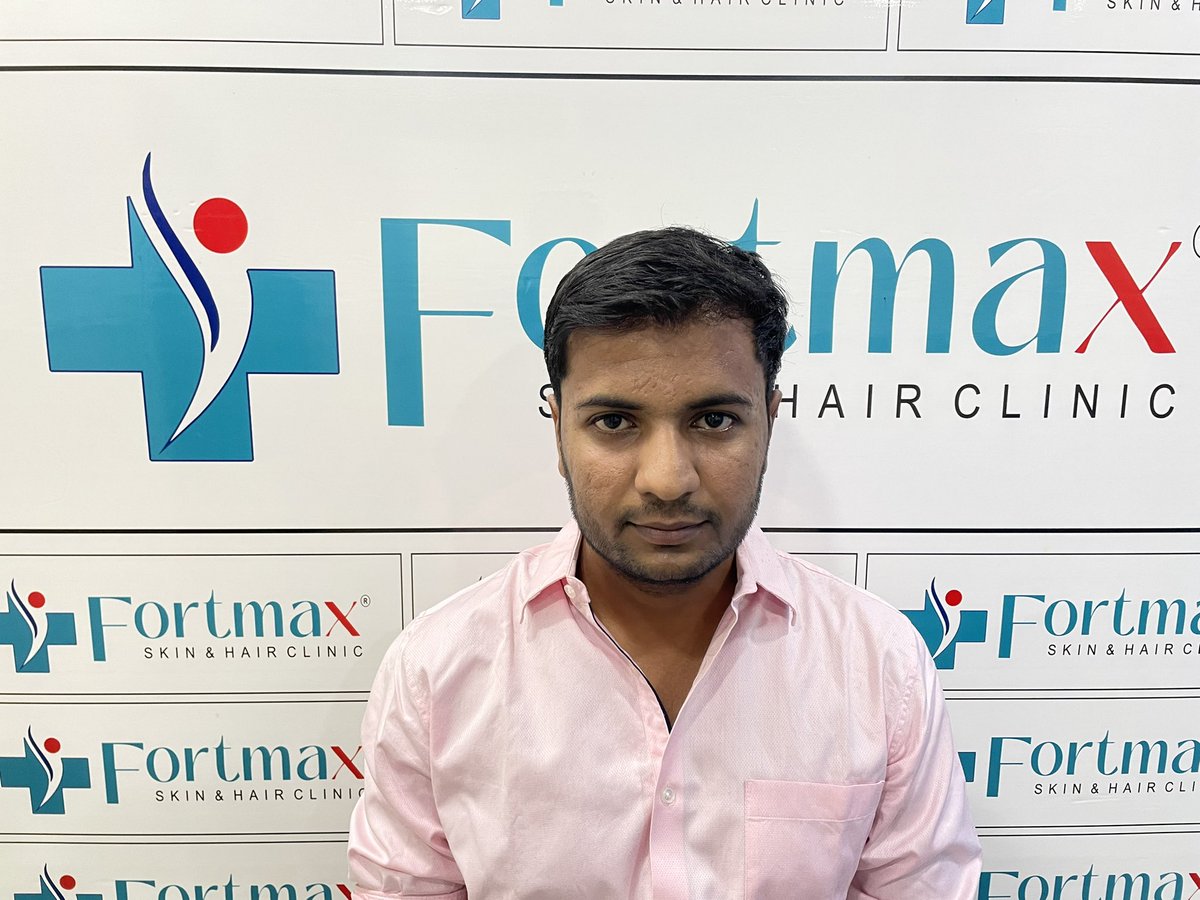 fortmaxclinic's tweet photo. #FortMaxClinic #HairTransplant #HairRestoration #HairLossSolution #ConfidenceBoost #EMIOffer #HairRevival #NewYou #HairTransformation #SelfAssurance #HairCare #BeConfident #HairGoals #ModernSolutions #HairTransplantdoctor #HairTreatment #Hairfall #Hairgrowth #Hairsolution https://t.co/PkbexjiNoK