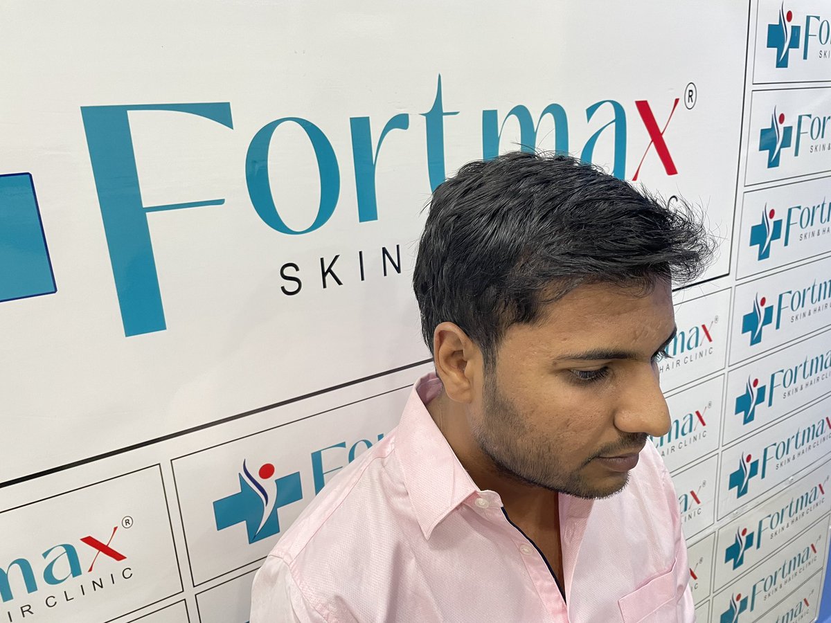 fortmaxclinic's tweet photo. #FortMaxClinic #HairTransplant #HairRestoration #HairLossSolution #ConfidenceBoost #EMIOffer #HairRevival #NewYou #HairTransformation #SelfAssurance #HairCare #BeConfident #HairGoals #ModernSolutions #HairTransplantdoctor #HairTreatment #Hairfall #Hairgrowth #Hairsolution https://t.co/PkbexjiNoK