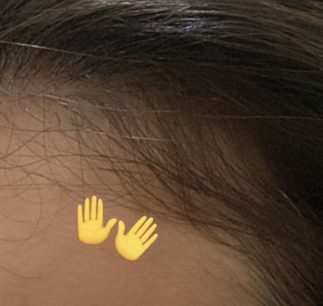 putrisilwii's tweet photo. @ohmybeautybank Aku pakai hair oil tumbuh lab, ngaruh banget. Pakai seminggu 2x sebelum keramas. Selain mengatasi rontok, di aku juga bisa numbuhin rambut. Jadi banyak baby hair 👌🏻 https://t.co/eX98VOYBsT