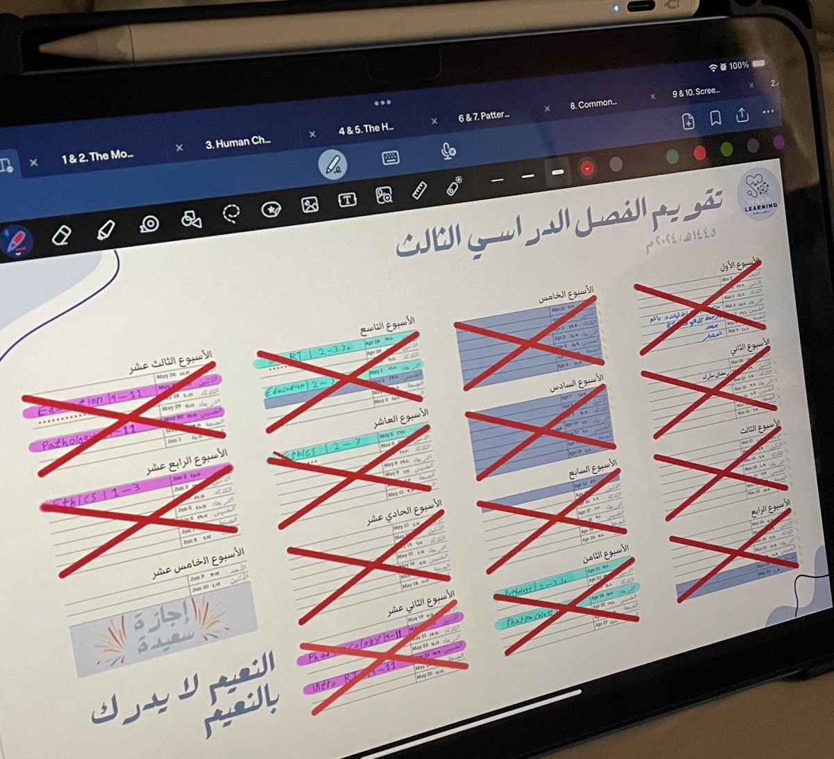 clvx_88's tweet photo. الحمدلله انتهت سنتين التحضيري بخيرها وشرها
سنتين صعبه جدا اكثر من 60 اختبار وبحوث و اشياء كثيره.
هذي البدايه بس و الرحله طويله ومن نجاح الى نجاح بحول الله تعال.
انتهت مرحلة كوشب و المرحله القادمه بعنوان
(بداية النهاية) ❤️❤️ #COSHP https://t.co/vMKmw6eIPX