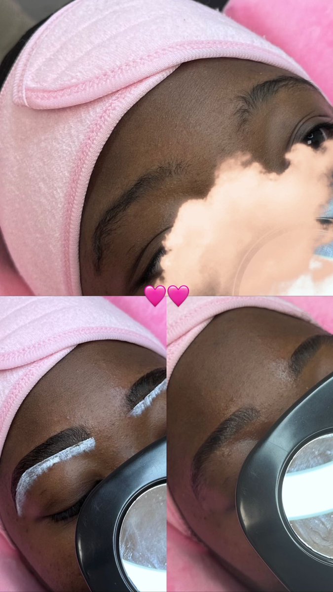 dix9i's tweet photo. @DearDark14 J’effectue des browlift et strass dentaires à prix grave abordable ! https://t.co/81zhJOnPok