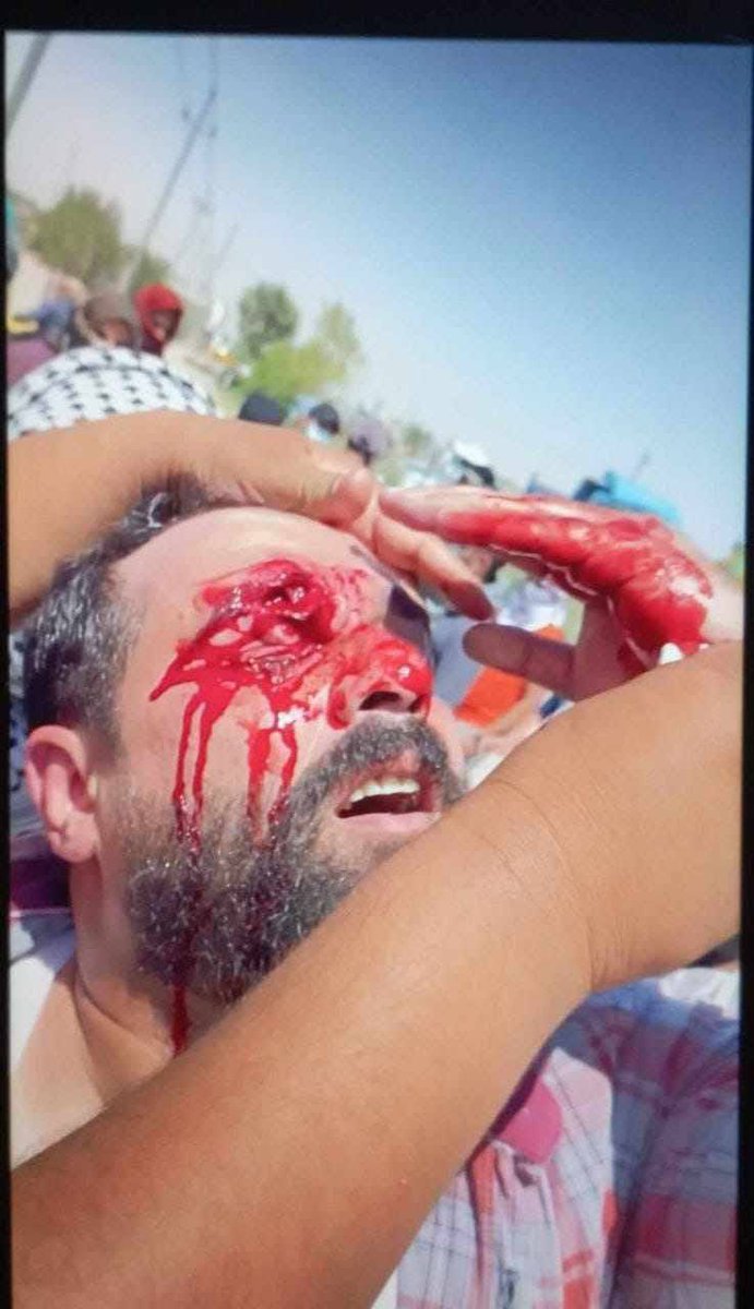 omaralreashey's tweet photo. 🚨مايتعرض له المتظاهرين السلميين في #ذي_قار وخصوصاً النساء من قمع وضرب وشتم وإهانة،تتحمله حكومة السوداني الفاشلة واحزاب السلطة.
#العراق_بلد_غير_آمن 
#اسلم_كريستيانو #البصرة #arap #الانسحاب_الاسراييلي_الكامل #محمد_بن_سلمان #المطالبة_بالقبض_على_معنف_الجوف 
 https://t.co/ZsOxZRU0kE